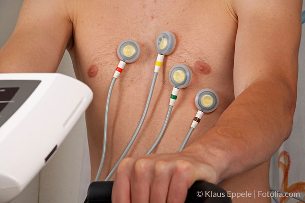 Im Belastungs-EKG kann der Blutdruck während körperlicher Anstrengung gemessen werden.